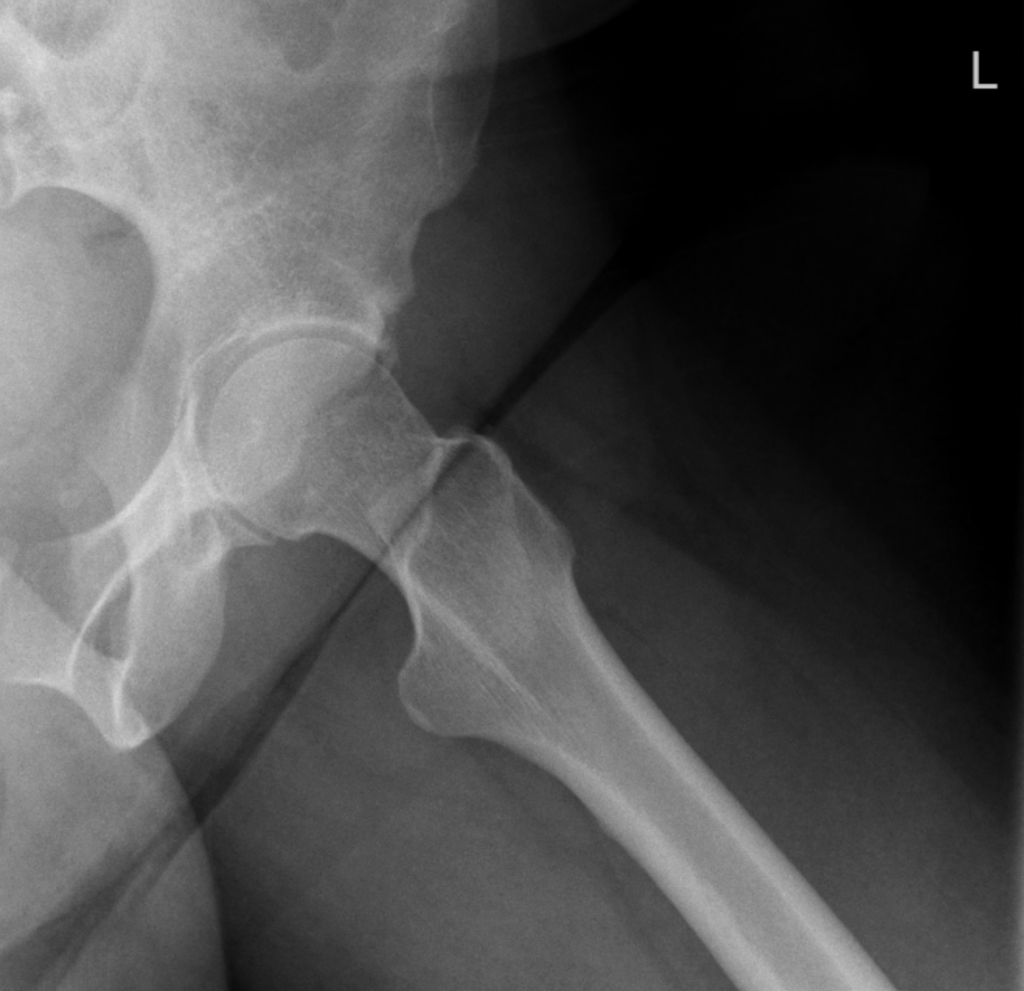 My Hip Is&nbsp;Hollering